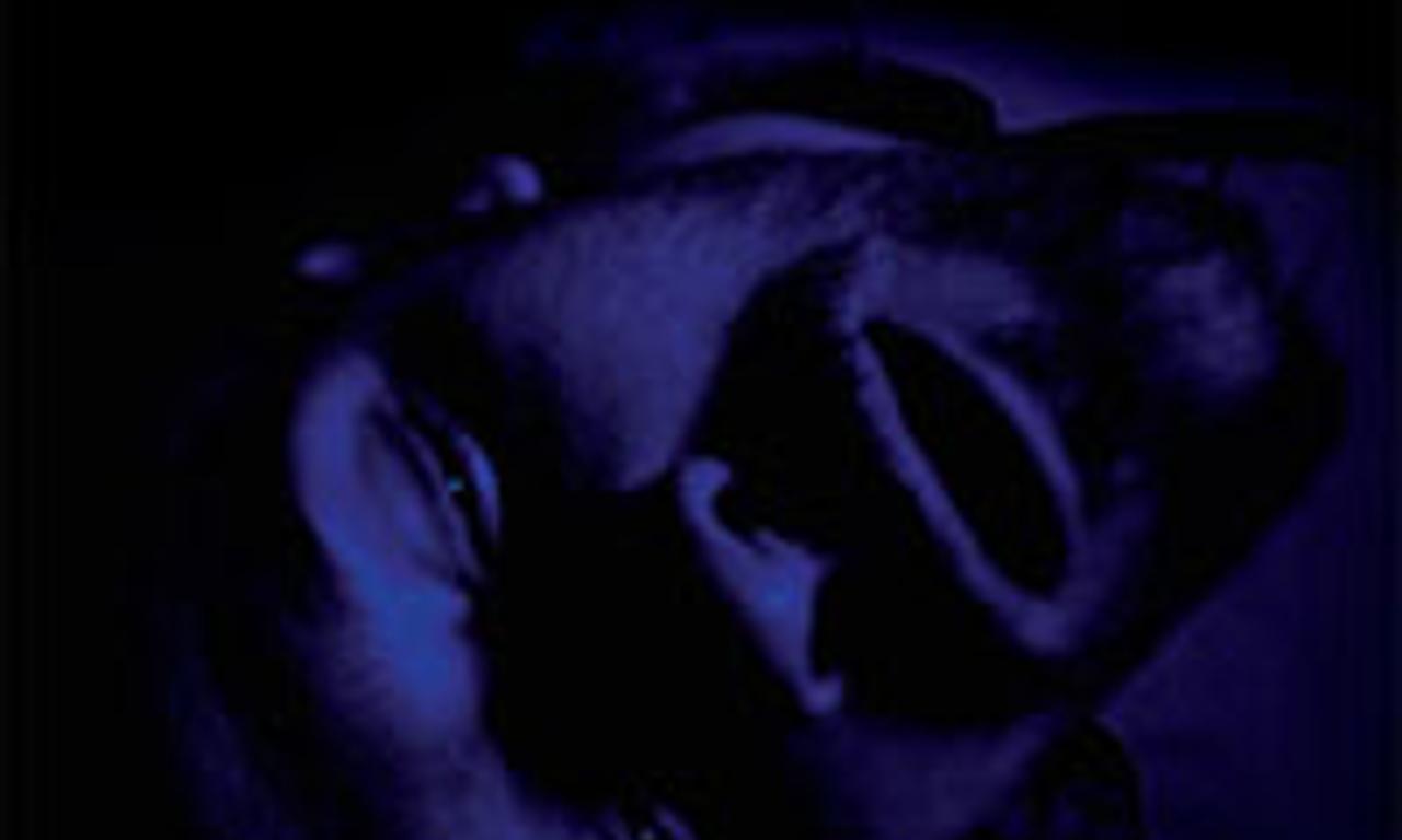 header image for The Dying Gaul