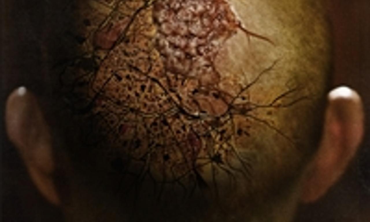 header image for Afflicted