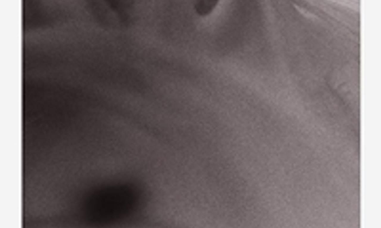 header image for Starfish