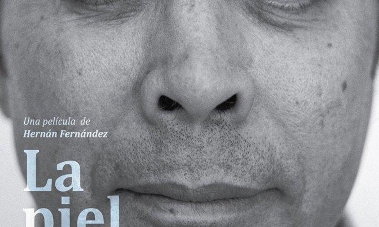header image for Scars