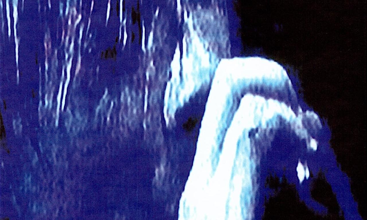 header image for Radiohead - The Astoria, London: Live