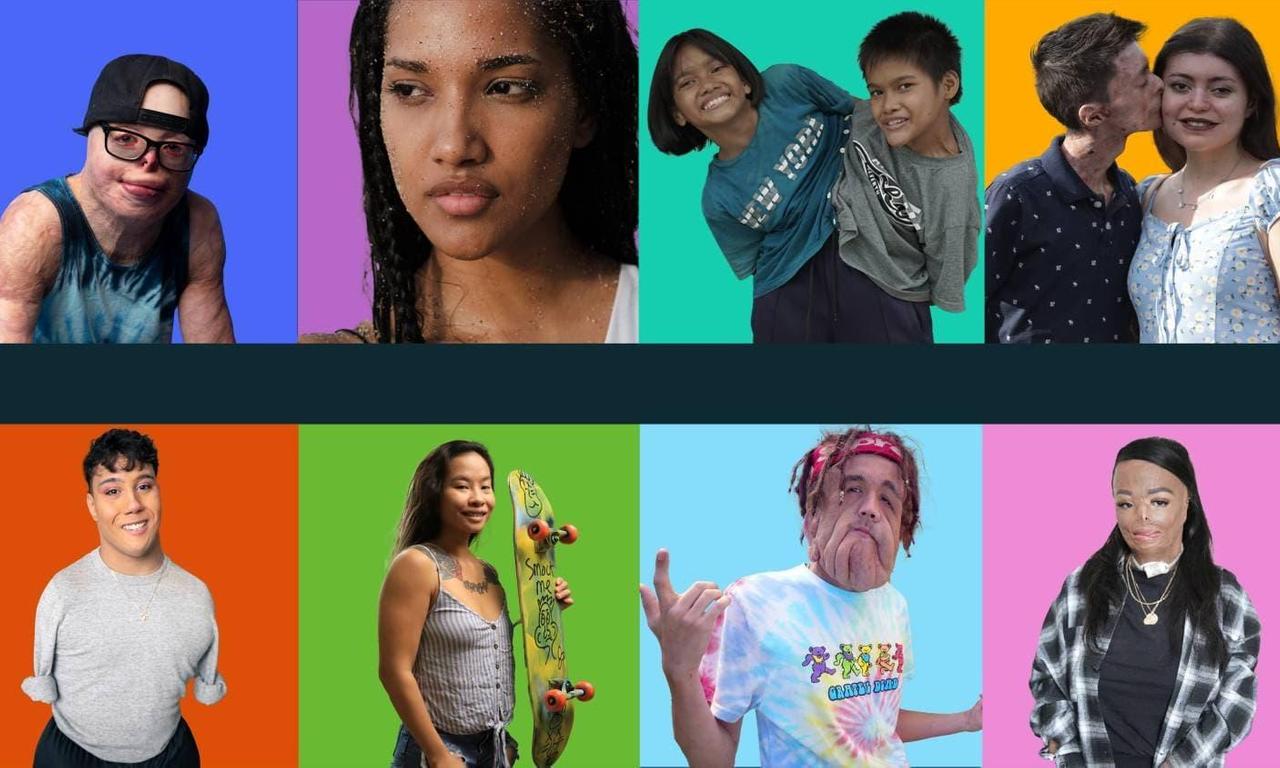 header image for Histórias de Superação