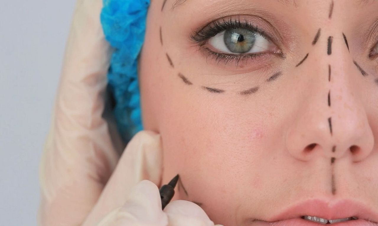 header image for Plastic Surgery Knifemares