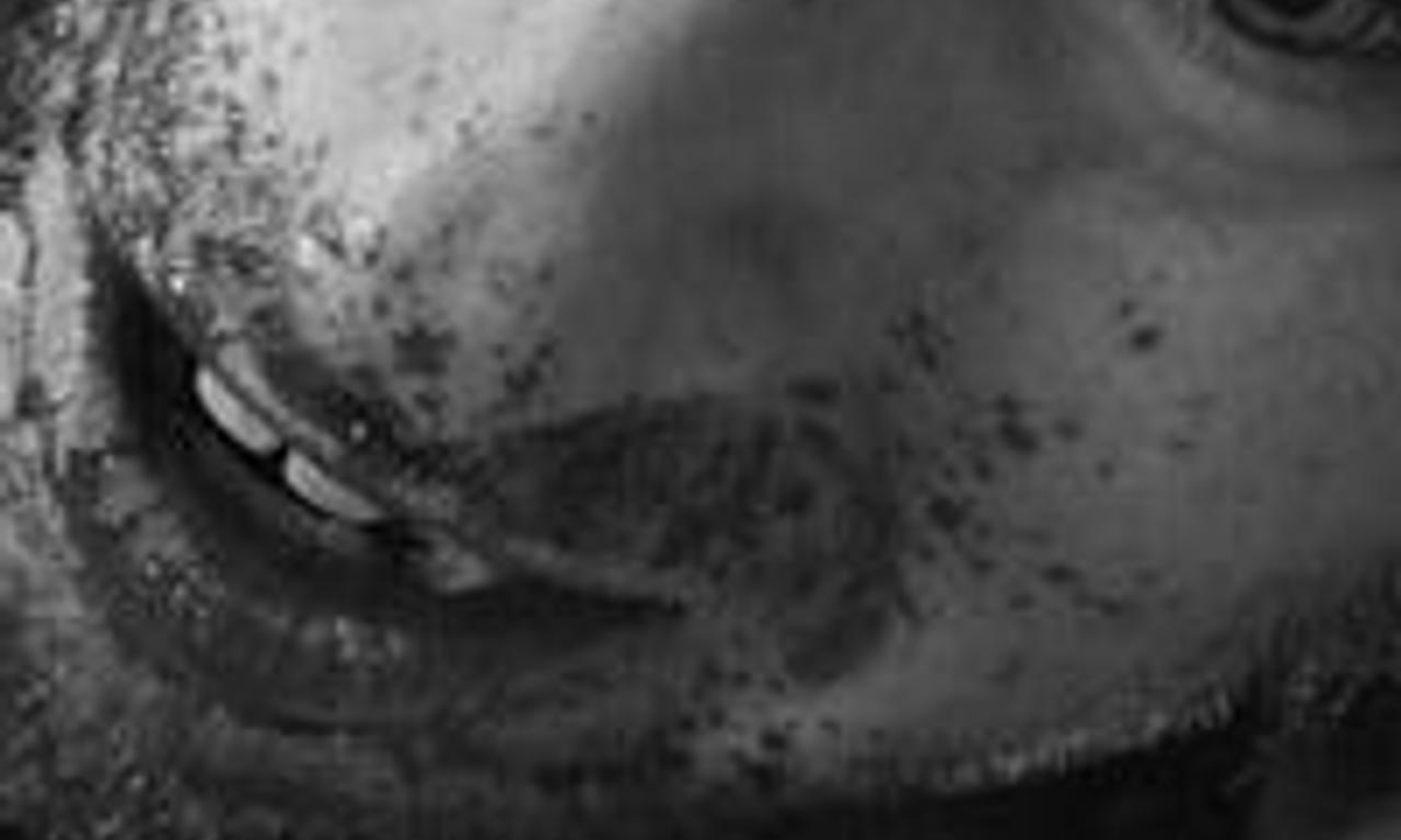 header image for Dementia Part II