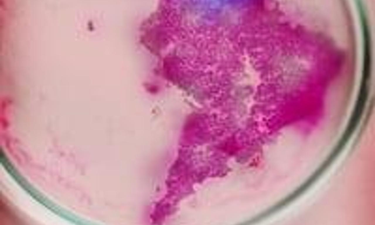 header image for Infection