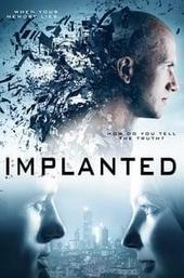 Implanted