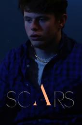 Scars