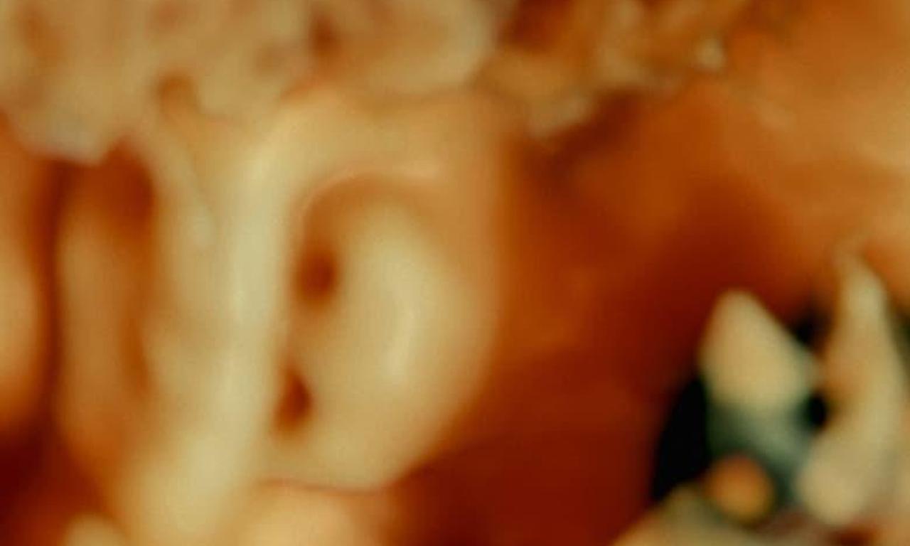 header image for De Humani Corporis Fabrica