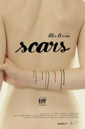 Scars