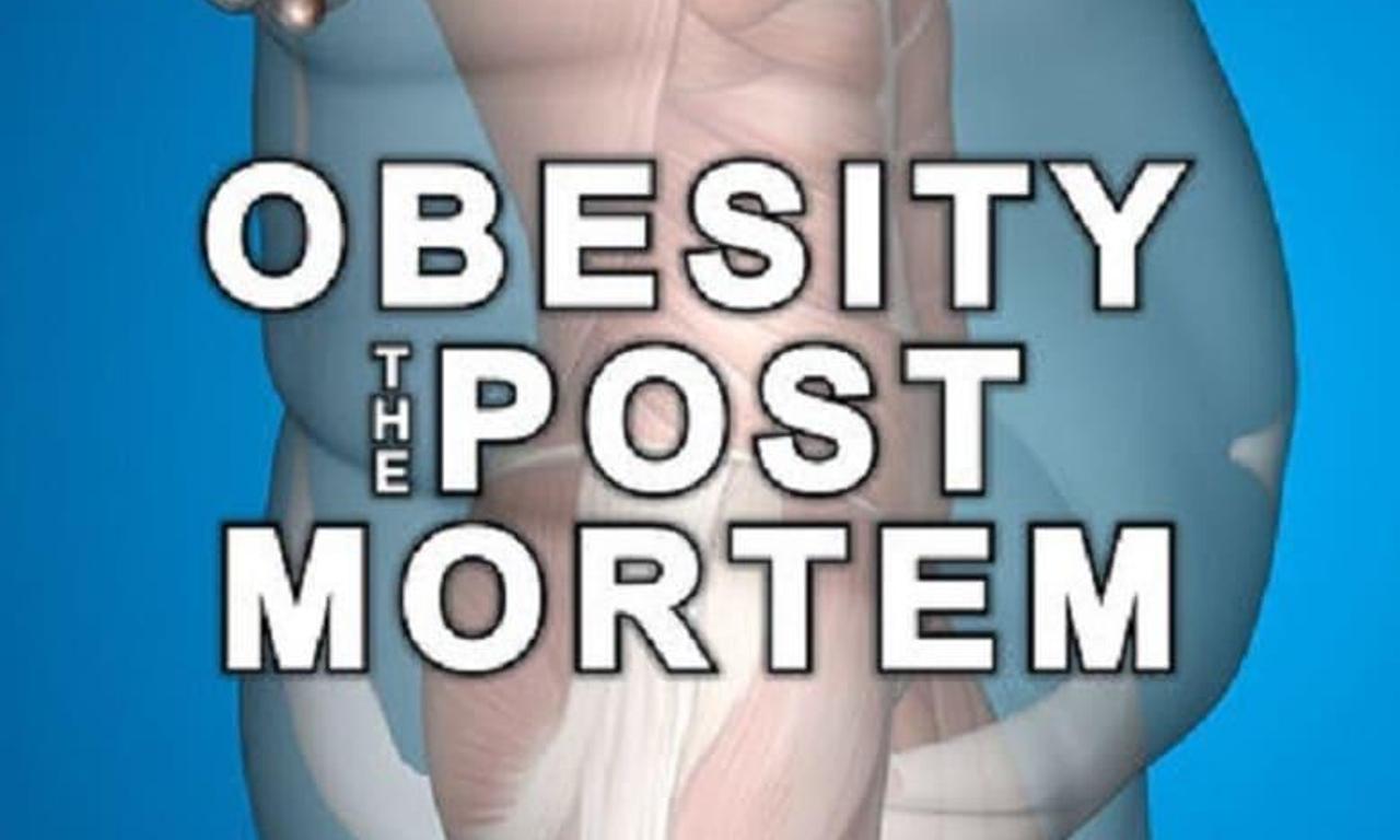 header image for Obesity: The Post Mortem