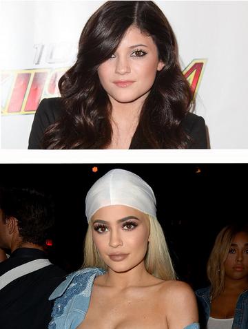 Biggest Celebrity Transformations