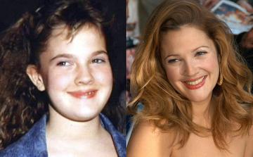 Before they were famous - Compare the Celebrity Photos