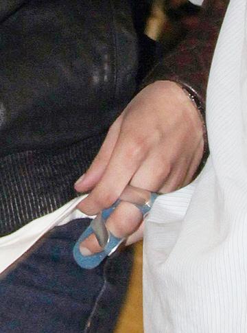 Kristen Stewart's Broken Finger