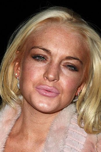 Celebrities Best and Worst Surgery