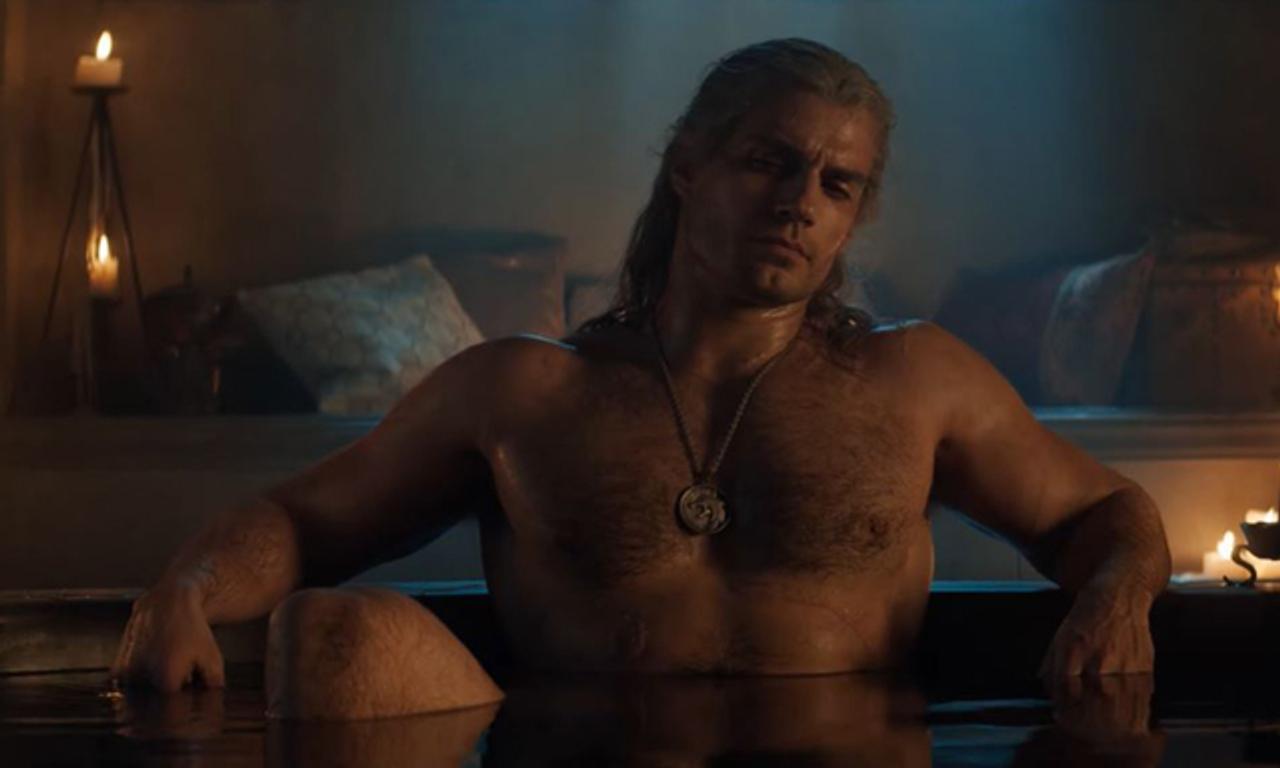 Henry Cavill injures leg during 'The Witcher' shoot